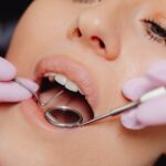 Zahnfarbe verändern durch Hygiene und Ernährung
